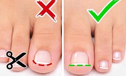 Taglio e cura delle unghie dei piedi sono importanti